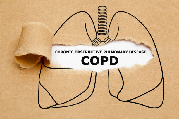 COPD is also sometimes called "emphysema" or "chronic bronchitis."