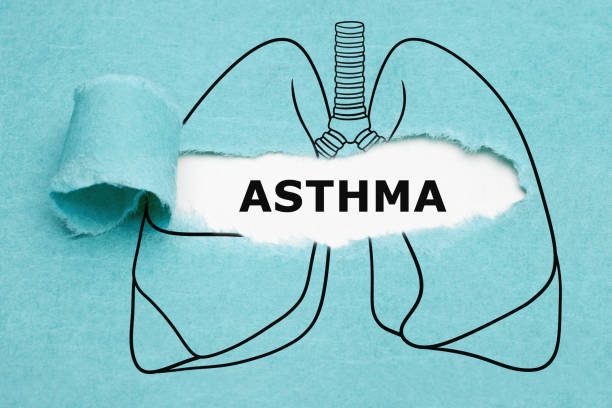 Asthma