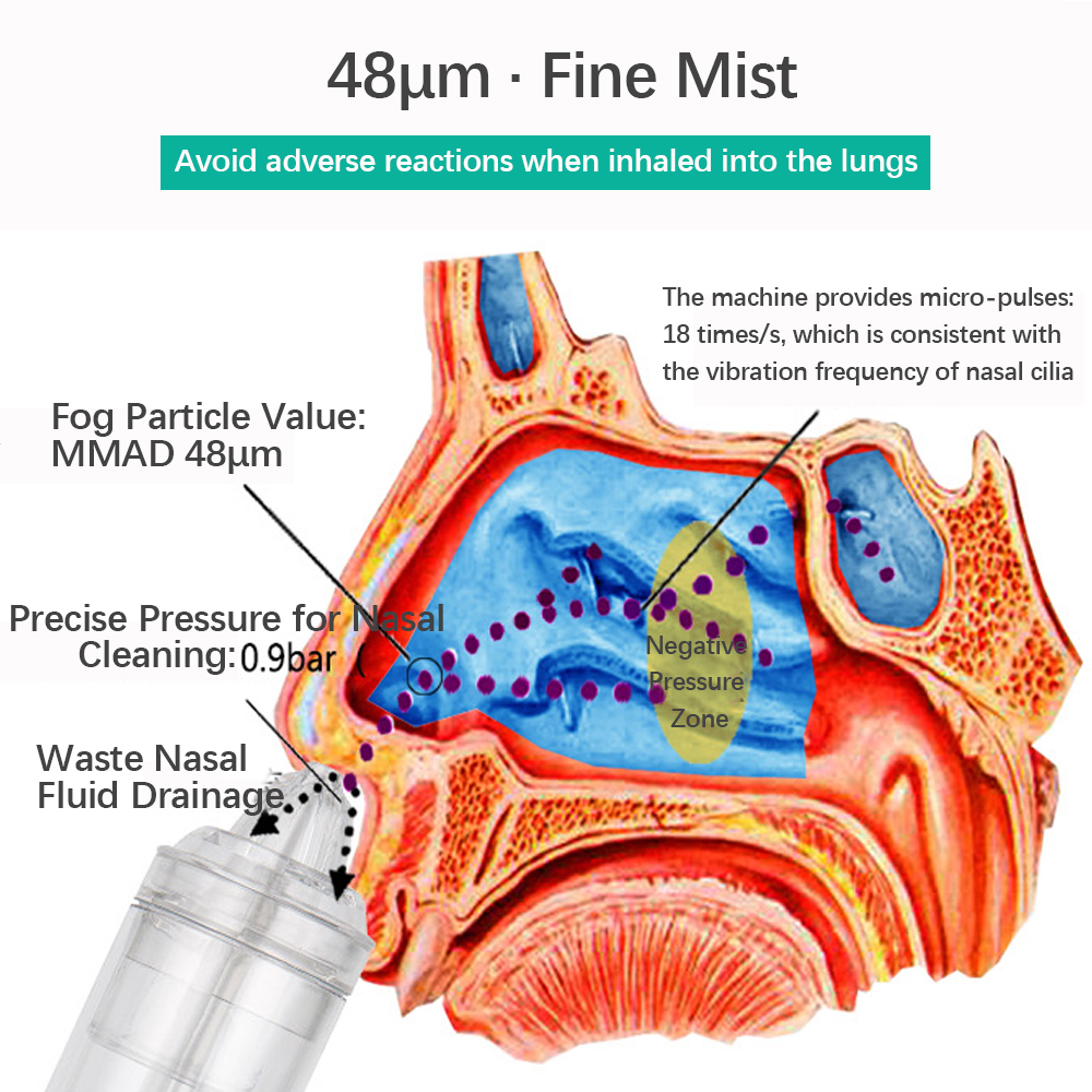 Aqua Maris Nasal Lavage – Rinse the nasal cavity and sinuses